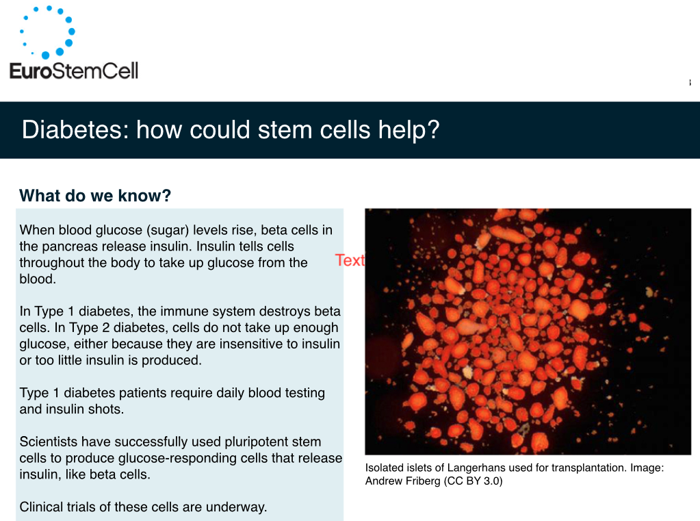 Diabetes – How might Stem Cells Help?